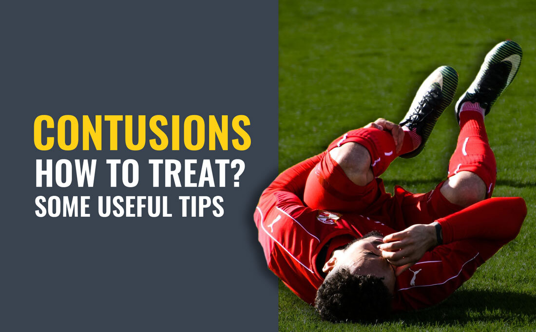 How to handle contusions